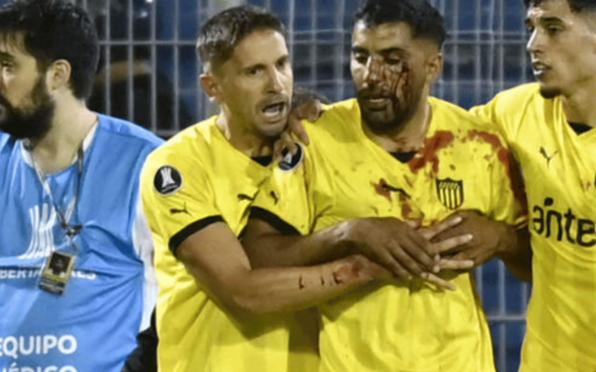 _Peñarol Lesionado por Agressão